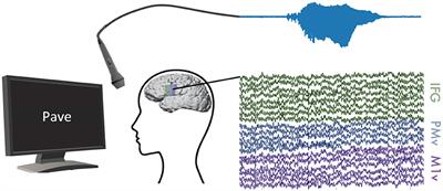 Generating Natural, Intelligible Speech From Brain Activity in Motor, Premotor, and Inferior Frontal Cortices